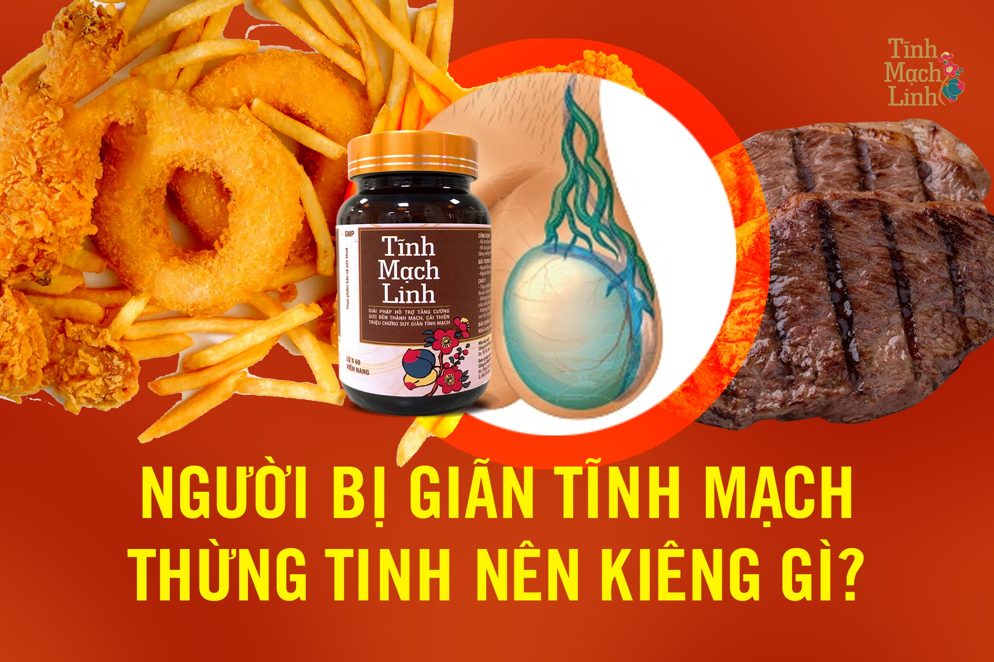 Người bị giãn tĩnh mạch thừng tinh nên kiêng gì?