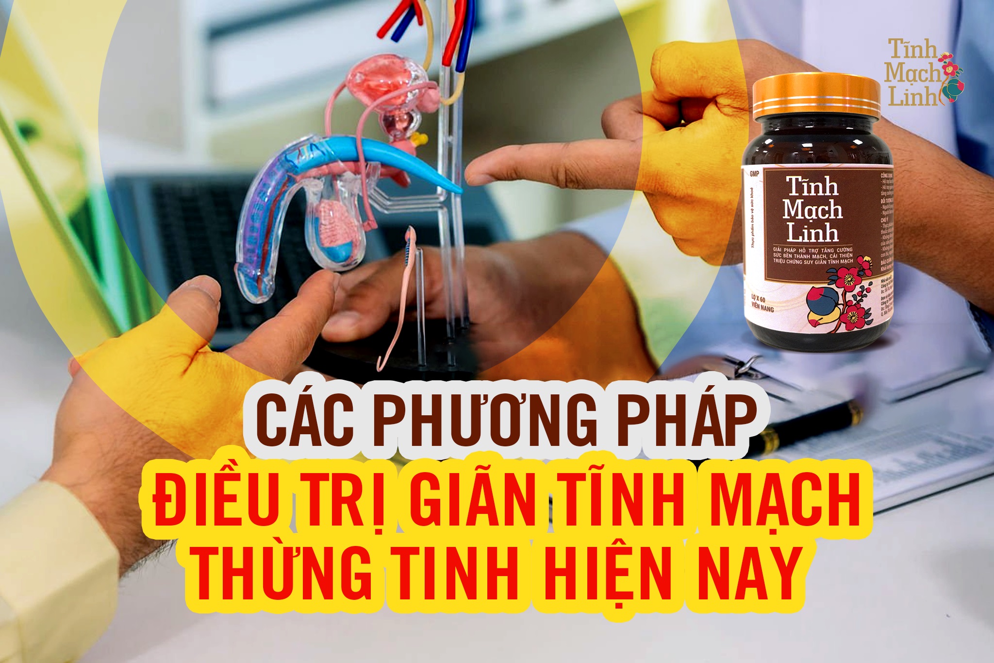Các phương pháp điều trị giãn tĩnh mạch thừng tinh hiện nay
