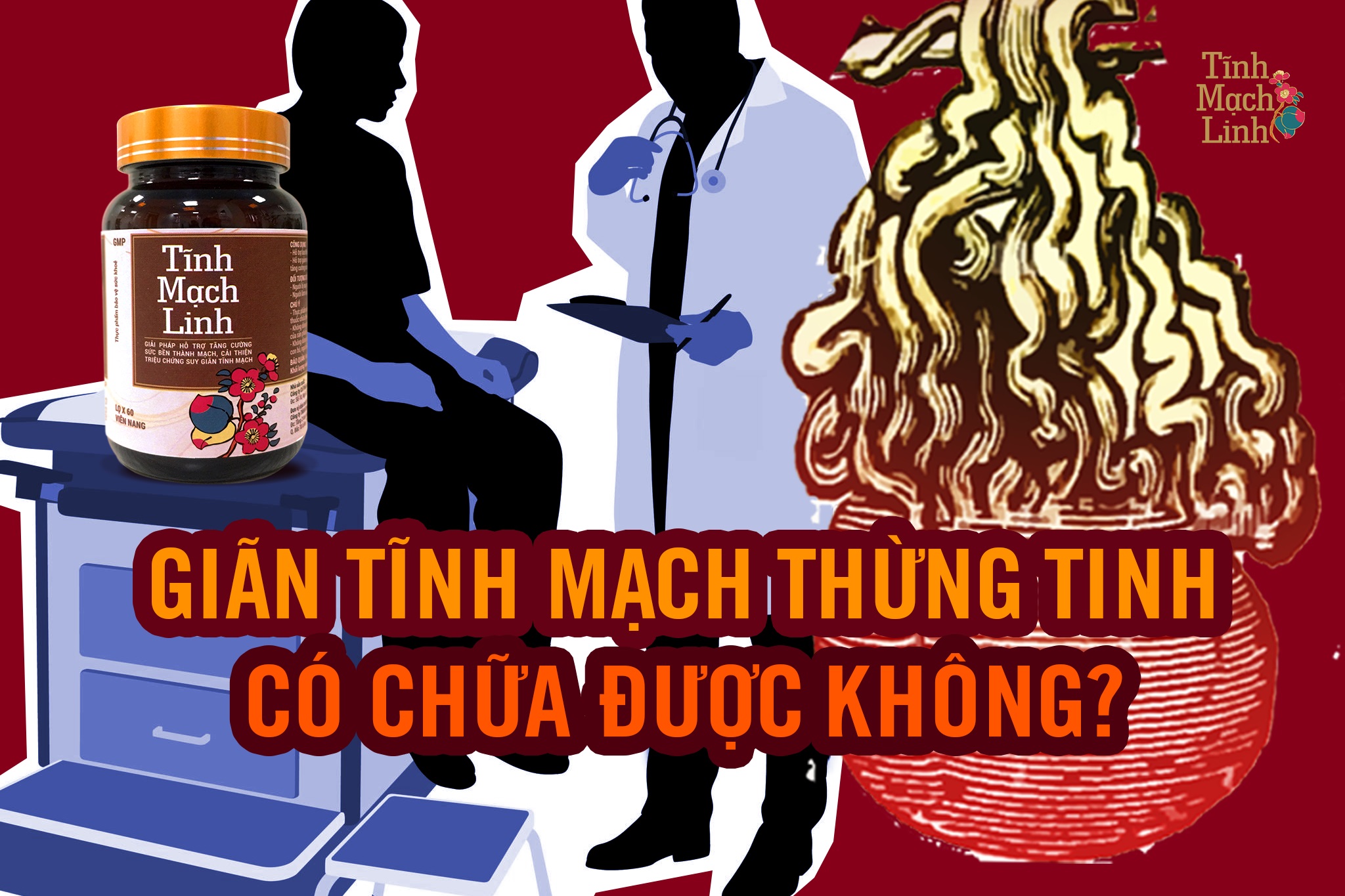 Giãn tĩnh mạch thừng tinh có chữa được không? Giải đáp từ chuyên gia