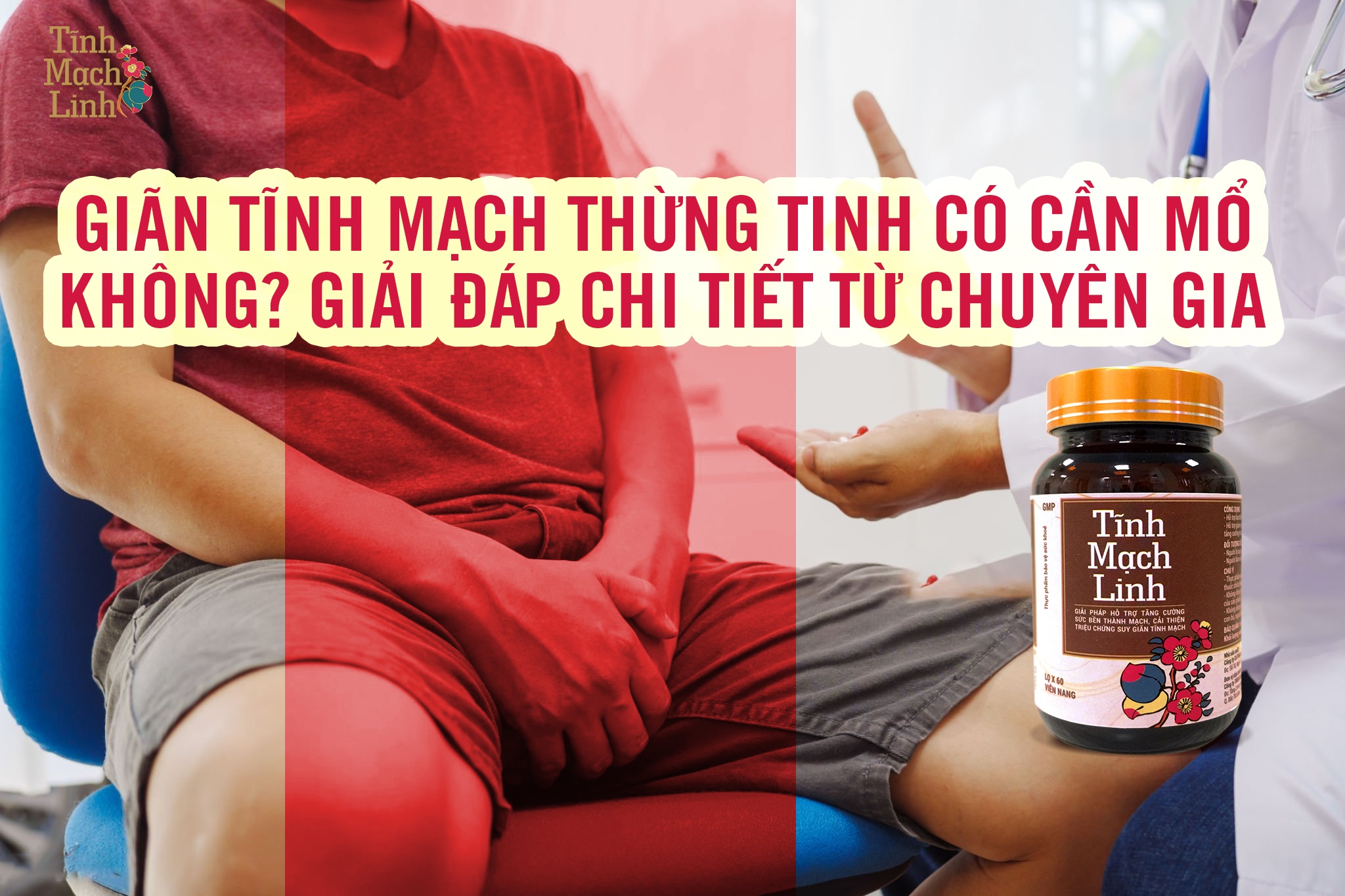 Giãn Tĩnh Mạch Thừng Tinh Có Cần Mổ Không? Giải Đáp Chi Tiết Từ Chuyên Gia