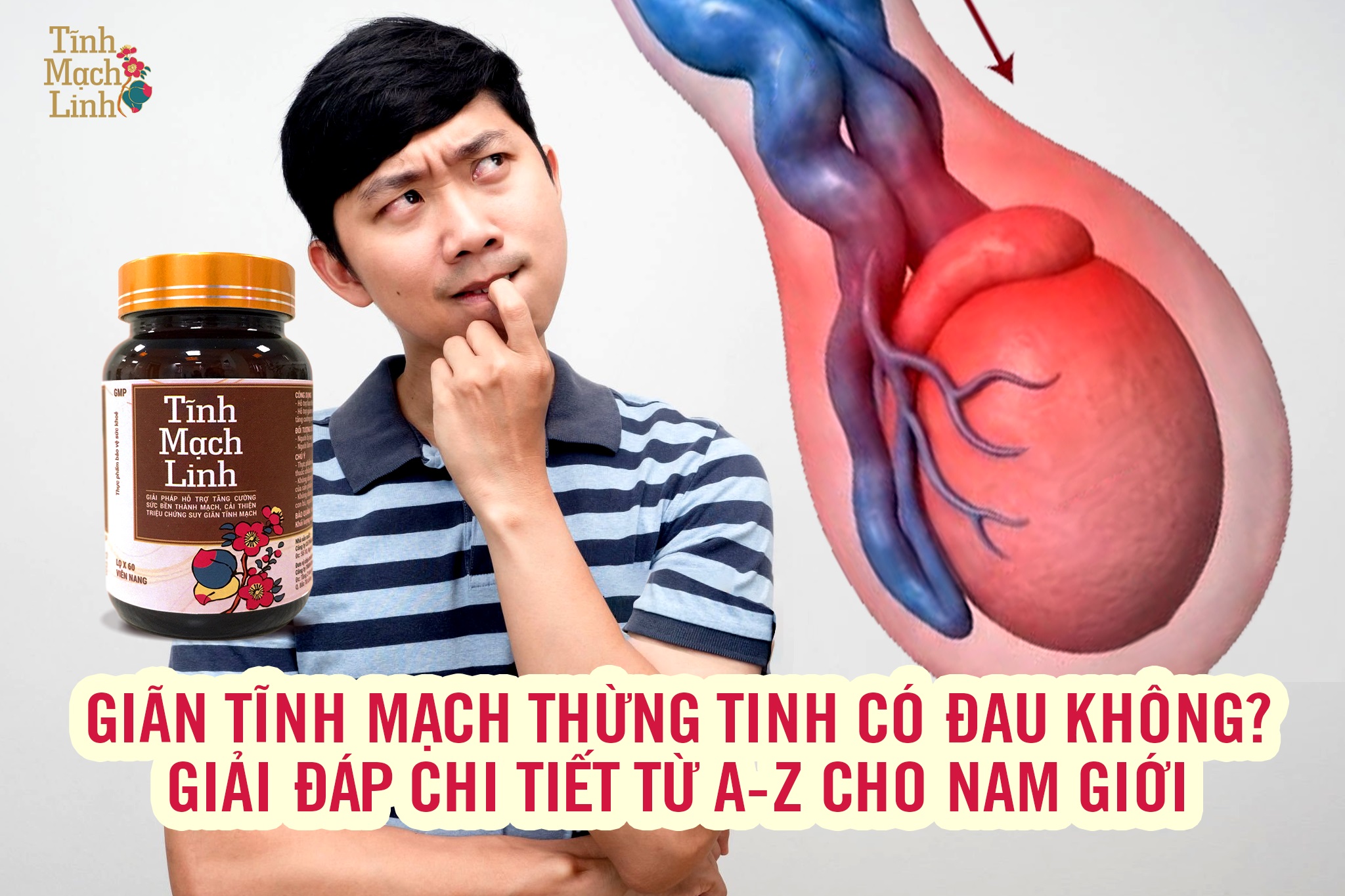 Giãn tĩnh mạch thừng tinh có đau không? Giải đáp chi tiết từ A–Z cho nam giới