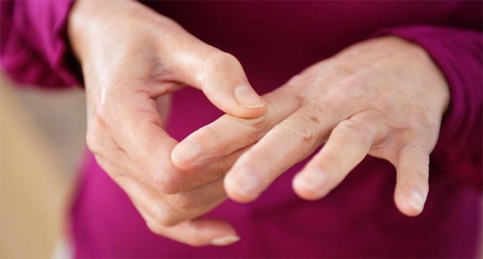 Tê đầu ngón tay: Phương pháp chẩn đoán và điều trị hiệu quả nhất