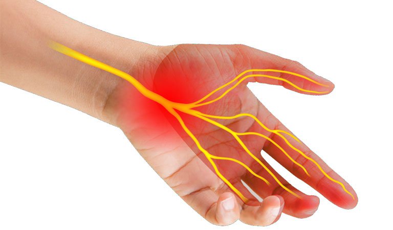 Hội chứng đau cổ tay là bệnh gì? Mách bạn 5 bài tập cải thiện đau cổ tay