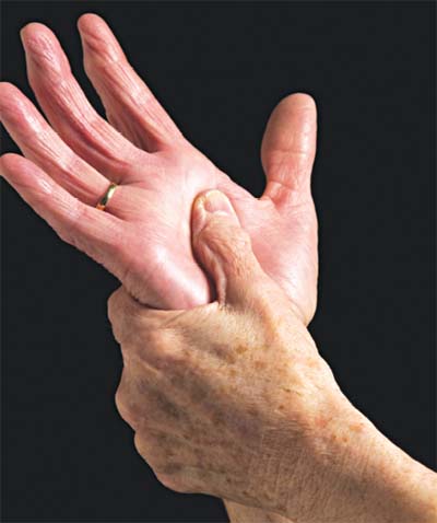 Tê mỏi cánh tay trái là bệnh gì và lời khuyên của bác sĩ chuyên khoa 
