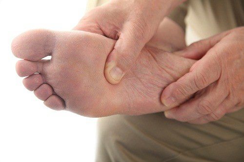 Tê bì chân: Biểu hiện cơ bản của bệnh lý bàn chân ở người tiểu đường