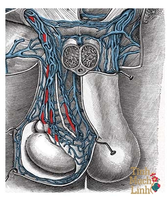 Giãn tĩnh mạch thừng tinh cấp độ 1 có khỏi được không?