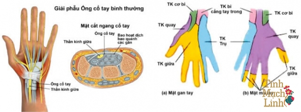 Hẹp ống cổ tay
